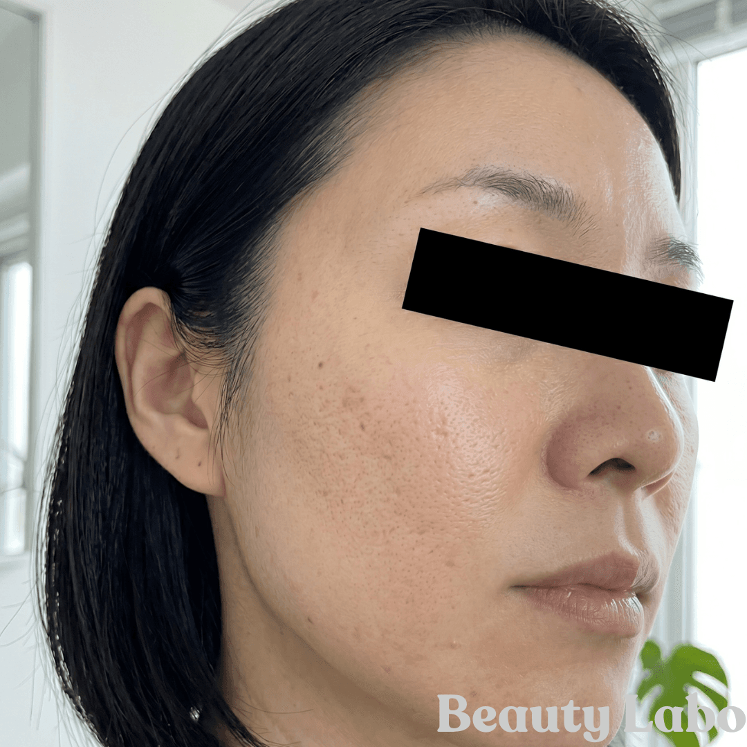 CASE02 After